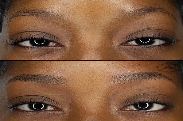 Microblading